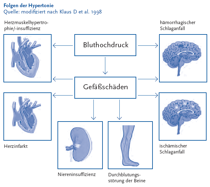 Abbildung 7 Die folgende Abbildung stellt die Folgen der Hypertonie in einem Schaubild dar. Quelle ist modifiziert nach Bluthochdruck und kardiovaskuläre Risikofaktoren. Ein Leitfaden für Arzt Patienten Seminare Neunzehnhundertachtundneunzig nach D. Klaus und S. Gleichmann. In der Mitte der oberen Hälfte des Schaubildes befindet sich ein Rechteck, in dem der Begriff Bluthochdruck steht. Links von diesem Rechteck befindet sich ein weiteres Rechteck, in dem ein Herz abgebildet ist mit der Bildunterschrift Herzmuskelhypertrophie schräg insuffizienz. Rechts von dem Rechteck befindet sich ein Rechteck, in dem ein Gehirn abgebildet ist mit der Bildunterschrift hämorrhagischer Schlaganfall. Vom Rechteck Bluthochdruck weisen Pfeile auf die anderen Rechtecke. Unterhalb des Rechteckes Bluthochdruck befindet sich ein weiteres Rechteck, in diesem steht der Begriff Gefäßschaden. Auch auf dieses wird mit Pfeil vom Rechteck Bluthochdruck verwiesen. Links neben dem Rechteck Gefäßschaden befindet sich ein Rechteck, in dem ein Herz abgebildet ist mit der Bildunterschrift Herzinfarkt, rechts neben dem Rechteck Gefäßschaden befindet sich ein Rechteck, in dem ein Gehirn abgebildet ist mit der Bildunterschrift ischämischer Schlaganfall. Unterhalb des Rechteckes Gefäßschaden befinden sich zwei nebeneinander liegende Rechtecke. In einem ist eine Niere abgebildet mit der Bildunterschrift Niereninsuffizienz, in dem anderen ist ein Bein abgebildet mit der Bildunterschrift Durchblutungsstörungen der Beine. Auf jedes der Rechtecke mit Abbildung einzelner Organe wird mit Hilfe jeweils eines Pfeils vom Rechteck Gefäßschaden verwiesen. Aus diesem Schaubild kann man erkennen, dass Bluthochdruck zu Gefäßschäden führen können. Diese wiederum können zu Herzmuskelhyperthrophie, Herzmuskelinsuffizienz, Herzinfarkt, Niereninsuffizienz, Durchblutungsstörungen der Beine, ischämischer Schlaganfall und oder hämorrhagischer Schlaganfall führen. Die Informationen aus dieser Abbildung werden gegebenenfalls auch im Text erläutert. Hinweis, falls Sie die Abbildung als Einzelfundstelle aus der Trefferliste gewählt haben: Sie stammt aus dem Themenheft 43 Hypertonie der Gesundheitsberichterstattung des Bundes, den Sie über den Link Verwandte, mit separater Stichwortsuche (Alt-Taste + Taste S) oder mit Hilfe des Links unterhalb der Abbildung erreichen können. Ende der Abbildungsbeschreibung.